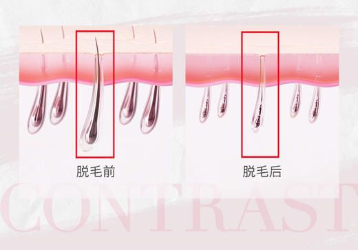 NITI养脱毛膏 2瓶装 脱毛男女专用腋下腿毛全身 商品图4