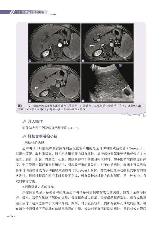 介入超声疑难病例解析 名除名医 超声疑难病例解析 介入超声医学感兴趣的临床医师的入门参考书 科学技术文献出版社9787523511787  商品图4