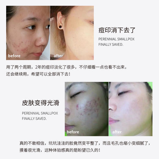 CJ寡肽原液 商品图5