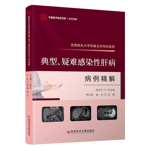 首都医科大学附属北京地坛医院 典型 疑难感染性肝病病例精解 邢卉春 中国医学临床百家病例精解 科学技术文献出版社9787523511817 商品图1