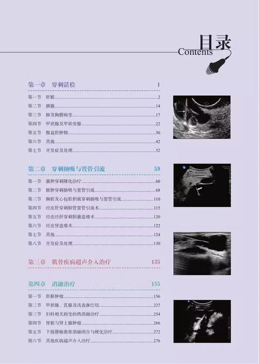 介入超声疑难病例解析 名除名医 超声疑难病例解析 介入超声医学感兴趣的临床医师的入门参考书 科学技术文献出版社9787523511787  商品图3