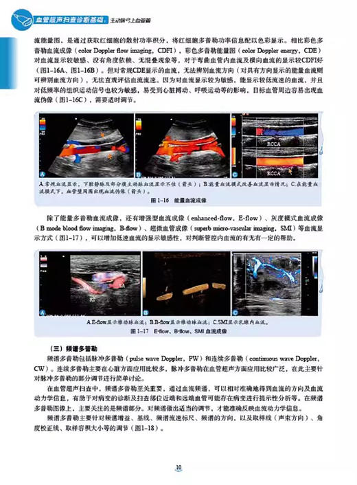 血管超声扫查诊断基础 主动脉弓上血管病 邹品飞 谭庆亭 主编 血管超声基础 血流动力学分析 科学技术文献出版社 9787523511978  商品图4