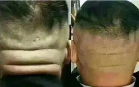  这种横纹预示着猝死，心梗，脑梗！一定要及时疏通 