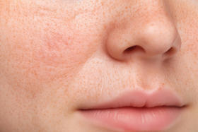 可以嚼着吃的胶原蛋白？这4种情况一定要试试！