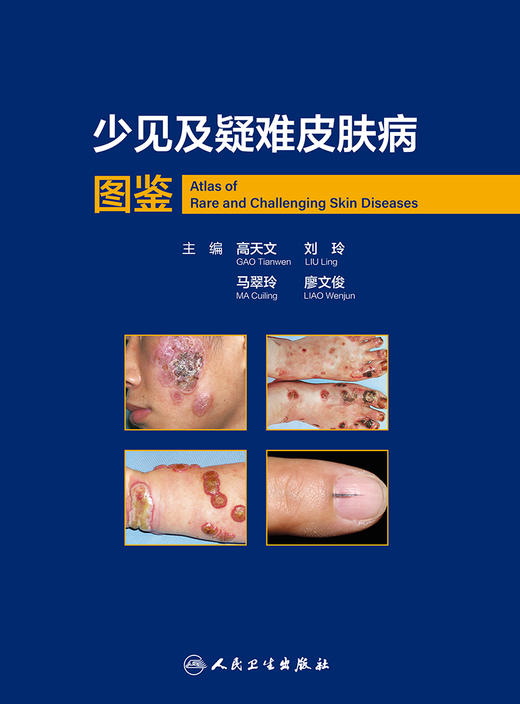 少见及疑难皮肤病图鉴 2024年4月参考书 商品图1