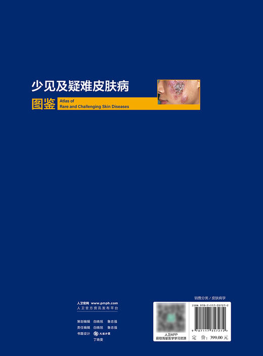 少见及疑难皮肤病图鉴 2024年4月参考书 商品图2