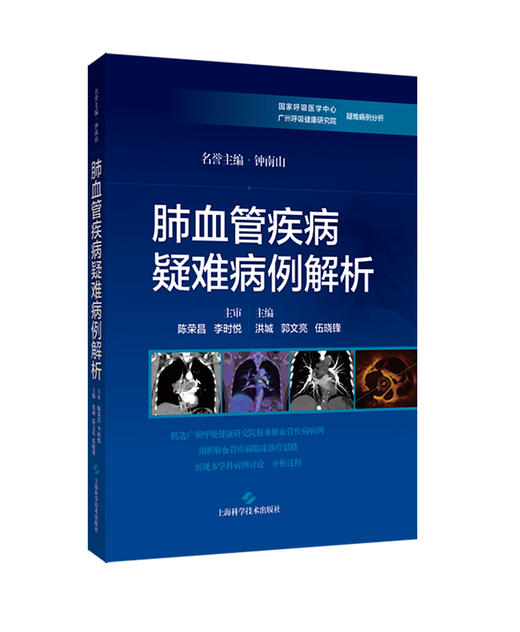 肺血管疾病疑难病例解析 供呼吸与危重症医学科 心血管内科等学科的医师 以及医学生和研究生 上海科学技术出版社9787547865309 商品图1