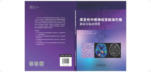 原发性中枢神经系统淋巴瘤基础与临床精要  血液病 肿瘤学 淋巴瘤-中枢神经系统-机制-诊断-治疗 商品图4