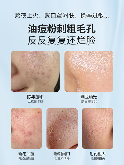 先生驾到祛痘精华液 商品图1