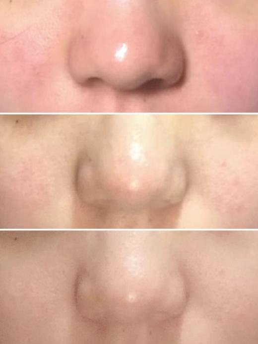 【清仓好价】DARPHIN/朵梵小粉瓶全效舒缓精华液15ml（效期至25.3-7月随机发） 商品图2