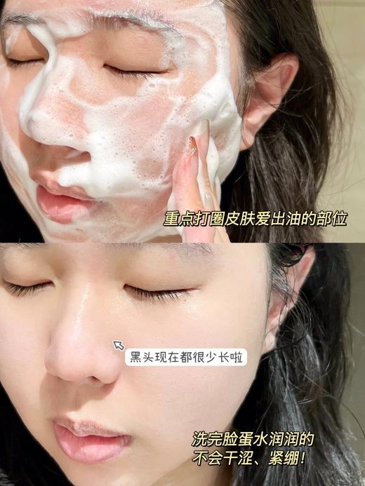 韩国beplain绿豆洗面奶女氨基酸洁面乳碧菲音深层清洁控油痘敏肌80ml 商品图4