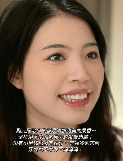 口腔专家权威推荐！俊小白美白牙膏去牙渍抑菌修护牙釉质防蛀护龈（26.11-12） 商品图11