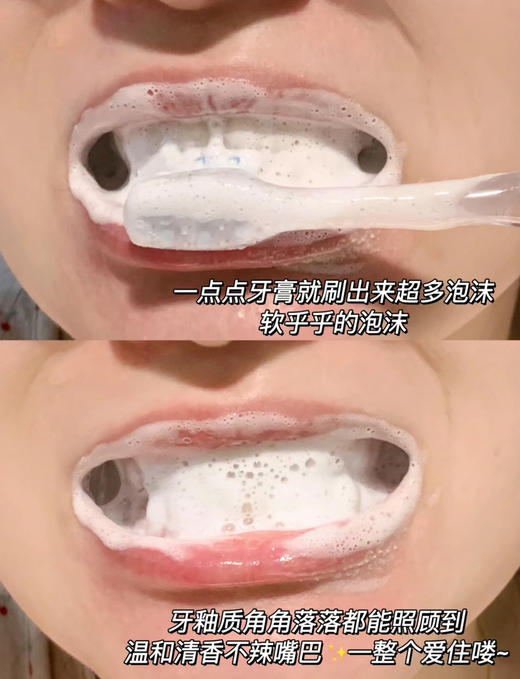 口腔专家权威推荐！俊小白美白牙膏去牙渍抑菌修护牙釉质防蛀护龈（26.11-12） 商品图10