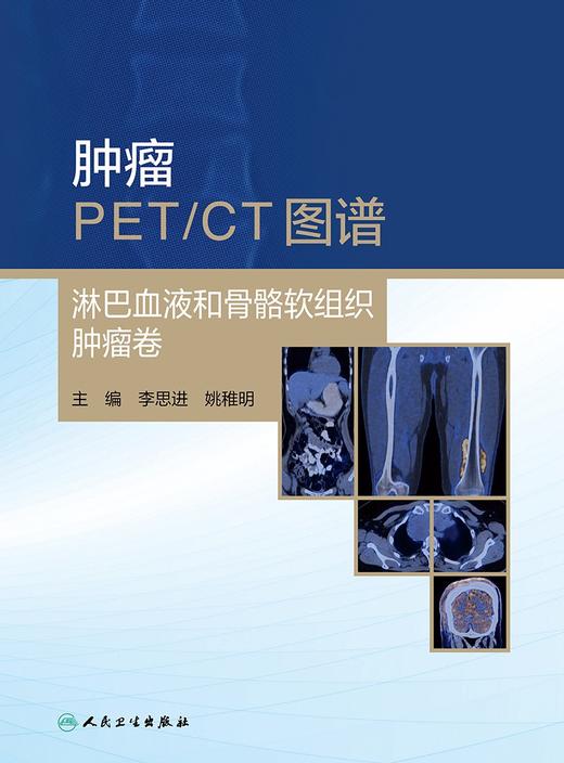 肿瘤PET/CT图谱——淋巴血液和骨骼软组织肿瘤卷 2024年4月参考书 商品图1