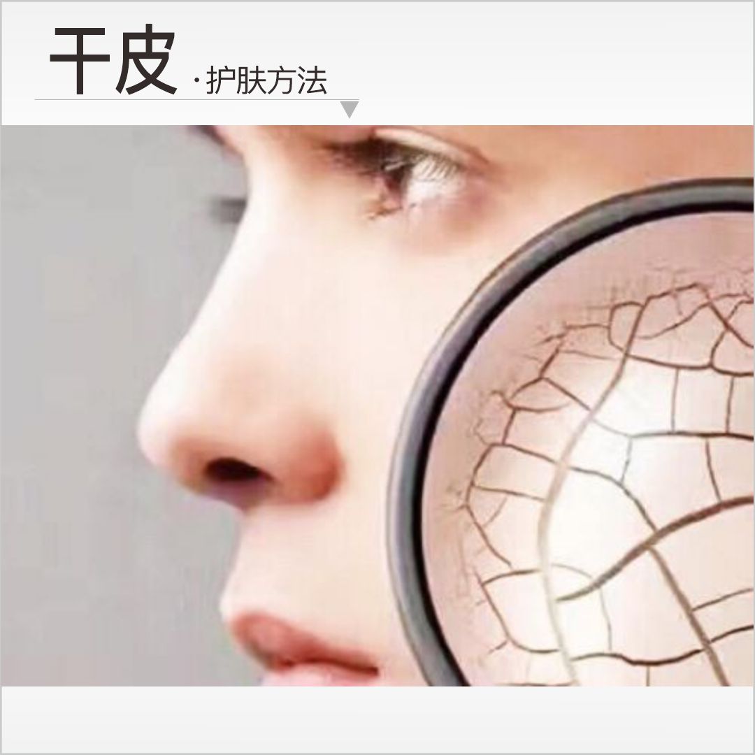 【干皮】护肤方法： ①以油养肤 ②蒸脸同时紧塑精华按摩 ③视黄醇抗皱  /神经酰胺养肤油