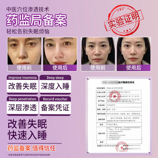 【踏青赏春| 会员专享特惠】安泰宁睡眠贴穴位磁疗灸多梦易醒醒不眠急躁神疲官方正品（限时抢购，抢完即止） 商品图7