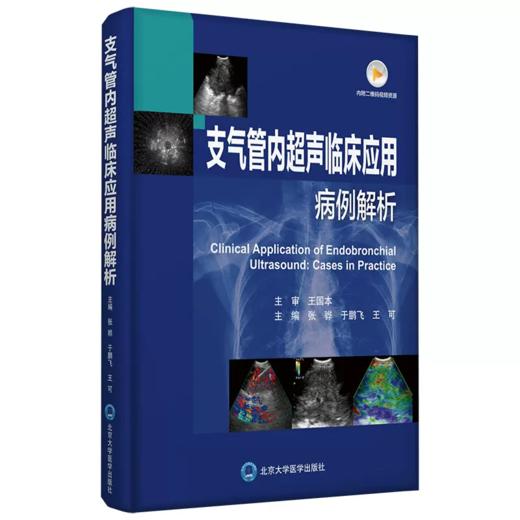 支气管内超声临床应用病例解析 张骅,于鹏飞,王可 编 商品图0