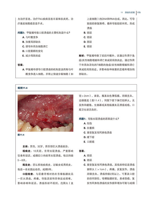 口腔黏膜病诊疗指南 季米特里斯·马拉穆斯 周瑜 根据病损类型及症状逐类描述口腔黏膜疾病不同年龄阶段口腔 9787559134455  商品图4