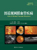 图说视网膜血管疾病 图说眼科系列丛书 陈青山 视网膜血管性疾病相关解剖学影像学与视功能学检查眼内液基因检测应用9787117360982 商品缩略图2