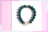 YKQS0003°孔雀石+金绿点四方财神隔珠手串 商品缩略图0