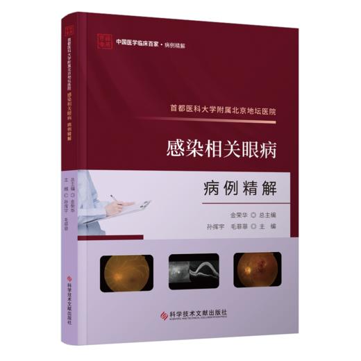 正版 首都医科大学附属北京地坛医院感染相关眼病病例精解 孙挥宇 毛菲菲主编 商品图0