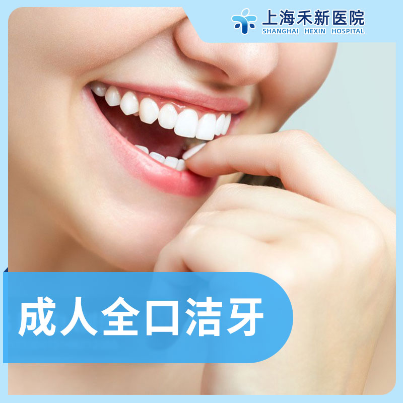 成人全口洁牙