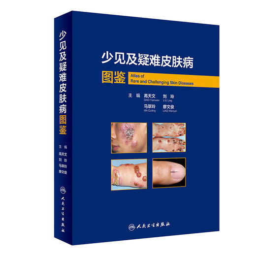 少见及疑难皮肤病图鉴 高天文等编 西京皮肤医院经病理诊断的少见疾病及临床错诊获修正的不典型疾病 人民卫生出版社9787117357272 商品图1