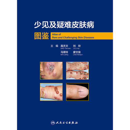 少见及疑难皮肤病图鉴 高天文等编 西京皮肤医院经病理诊断的少见疾病及临床错诊获修正的不典型疾病 人民卫生出版社9787117357272 商品图3