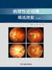 病理性近视眼眼底改变（第二版） 方严   石一宁主编 商品缩略图1