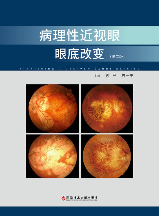病理性近视眼眼底改变（第二版） 方严   石一宁主编 商品图1