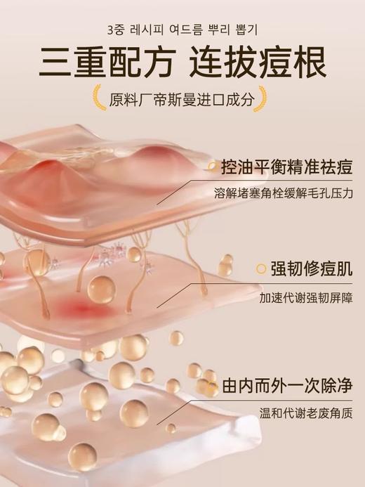 【祛痘小金瓶 油痘肌0反复】泛醇维生素精华液30ml#B56祛痘精华液淡化痘印改善黑头粉刺收敛毛孔油皮原液正品 商品图1