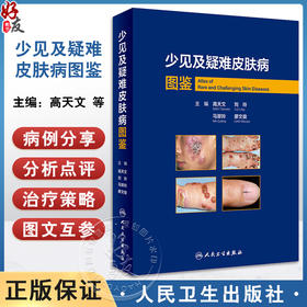 少见及疑难皮肤病图鉴 高天文等编 西京皮肤医院经病理诊断的少见疾病及临床错诊获修正的不典型疾病 人民卫生出版社9787117357272