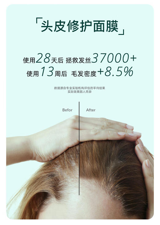 【清仓好价】Esthecin荷乐生小绿管密发精华10ml*8/盒 1盒/2盒（效期至24.10后） 商品图2