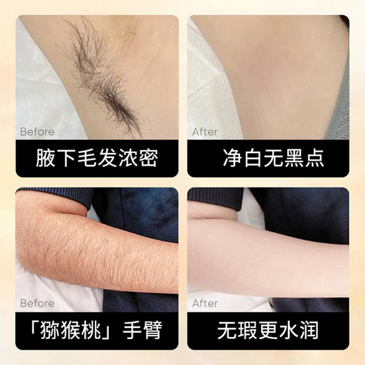 【轻松告别“猕猴桃”女孩！】 上朵丝滑净肤脱毛膏，温和清洁 全身通用去腋毛净肤脱毛膏，深层脱毛 不留黑点毛渣。-ry 商品图4
