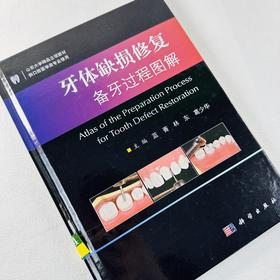 牙体缺损修复备牙过程图解/牙体缺损修复备牙过程图解/蓝菁 林东 葛少华