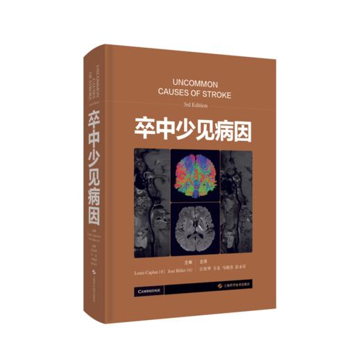 卒中少见病因 商品图0