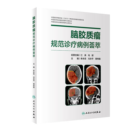 脑胶质瘤规范诊疗病例荟萃 2024年6月参考书 商品图0