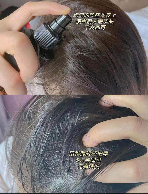 【清仓好价】日本漾新族防脱育发精华露200ml（效期至25.2） 商品图1