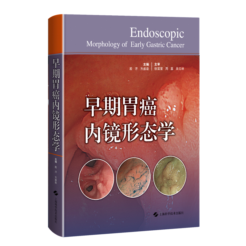 早期胃癌内镜形态学
