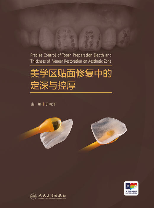 美学区贴面修复中的定深与控厚 2024年4月参考书 商品图1