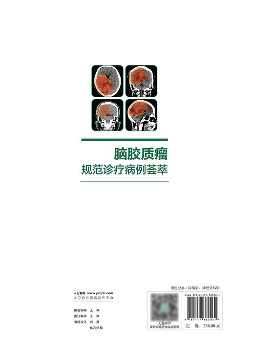 脑胶质瘤规范诊疗病例荟萃 2024年6月参考书 商品图2