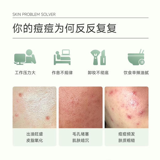 可复美净痘修护面膜5片/盒 商品图1