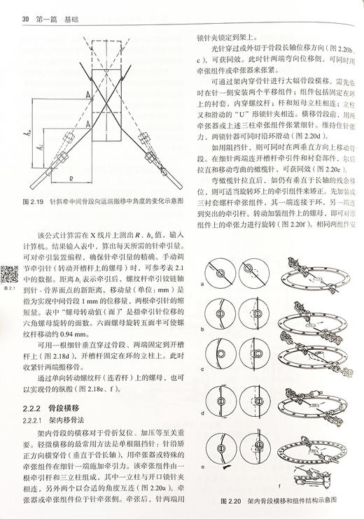 Ilizarov 骨外固定术 组织再生和生长的理论与临床 骨科疾病手足腕肢体创伤组织矫形外科胫骨重塑修复固定术 9787565931222 商品图4