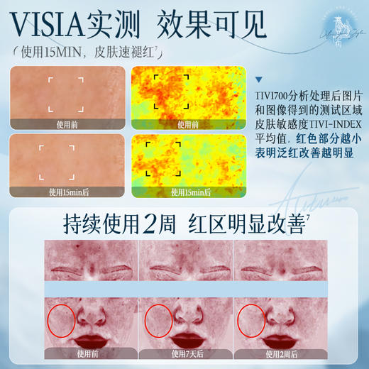 【🔥低至￥49.7/件|149选3件|9月超级会员日】冰沙面霜补水保湿滋润舒缓春夏季修护敏感肌保湿霜|儒意官方旗舰店 商品图5