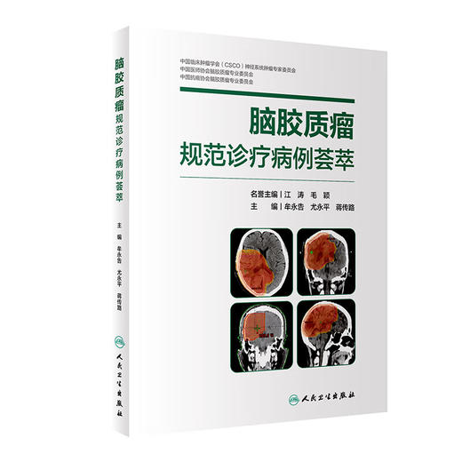 脑胶质瘤规范诊疗病例荟萃 牟永告 尤永平 蒋传路 神经外科疑难病例热点话题专家点评疾病临床诊治 人民卫生出版社9787117362061 商品图1