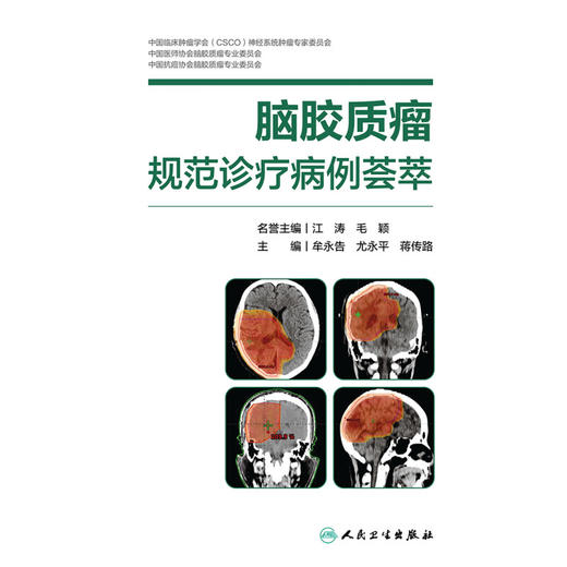 脑胶质瘤规范诊疗病例荟萃 牟永告 尤永平 蒋传路 神经外科疑难病例热点话题专家点评疾病临床诊治 人民卫生出版社9787117362061 商品图3