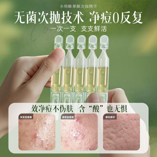 儒意水杨酸果酸次抛精华液30支/盒  修复去祛痘 淡化痘印 收缩毛孔粗 祛闭口粉刺  | 儒意官方商城 商品图2