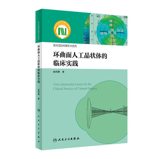 环曲面人工晶状体的临床实践（屈光性白内障手术系列） 2024年4月参考书 商品图0