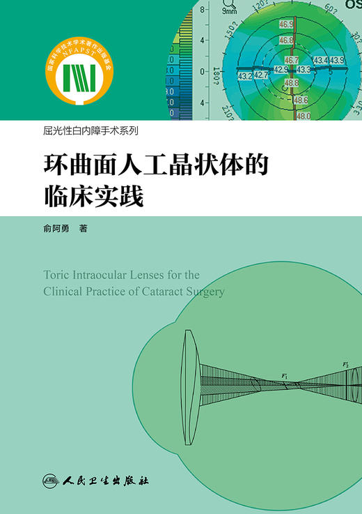 环曲面人工晶状体的临床实践（屈光性白内障手术系列） 2024年4月参考书 商品图1