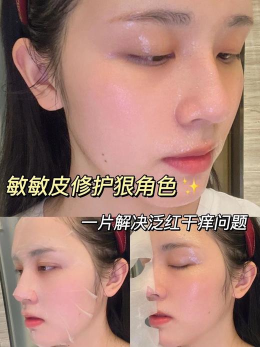 可复美重组胶原蛋白修护贴 妆字号[30g/片]*4片 商品图10